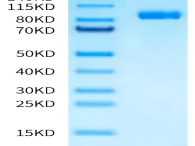 Human APCDD1 Protein (APD-HM201)