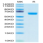 Mouse APCDD1 Protein (APD-MM101)