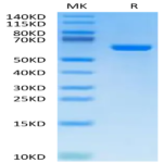 Cynomolgus Alkaline Phosphatase (Placental type) /ALPP Protein (APE-CM102)