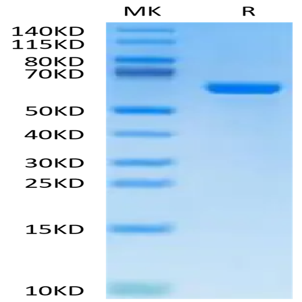 Cynomolgus Alkaline Phosphatase (Placental type) /ALPP Protein (APE-CM102)