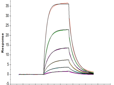 Human Alkaline phosphatase (Intestinal type) /ALPI Protein (APE-HM101)