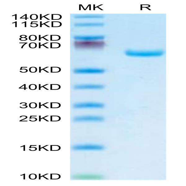 Human Alkaline Phosphatase (Placental type) /ALPP Protein (APE-HM102)