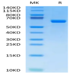 Human Alkaline Phosphatase (Germ type) /ALPG Protein (APE-HM103)