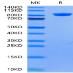Human Alkaline Phosphatase (Germ type) /ALPG Protein (APE-HM203)