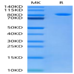 Human Alkaline Phosphatase (Germ type) /ALPG Protein (APE-HM303)