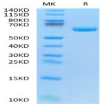 Biotinylated Human Alkaline Phosphatase (Germ type) /ALPG Protein (APE-HM403B)