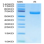 Mouse Alkaline phosphatase (Intestinal type) /ALPI Protein (APE-MM101)