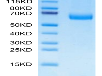 Mouse Alkaline phosphatase (Intestinal type) /ALPI Protein (APE-MM101)