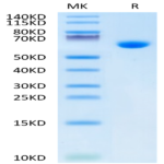 Mouse Alkaline Phosphatase (Germ type) /ALPG Protein (APE-MM103)