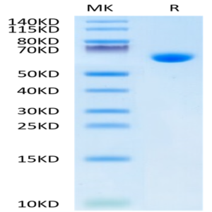 Mouse Alkaline Phosphatase (Germ type) /ALPG Protein (APE-MM103)