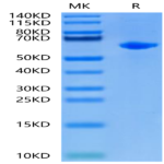 Rat Alkaline Phosphatase (Germ type) /ALPG Protein (APE-RM103)