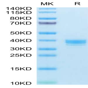 Human APLN Protein (APN-HM201)