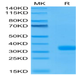 Human ANGPT2/Angiopoietin-2 Protein (APN-HM401)