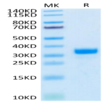 Biotinylated Human ANGPT2/Angiopoietin-2 Protein (APN-HM401B)