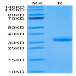 Mouse ANGPT2/Angiopoietin-2 Protein (APN-MM101)
