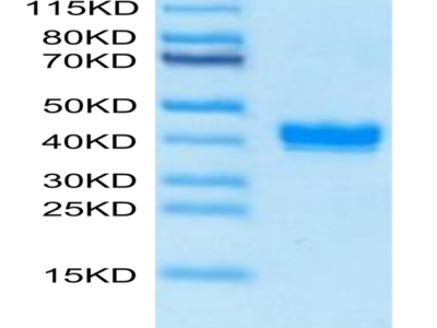 Biotinylated Mouse APLN Protein (APN-MM501B)