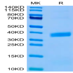 Biotinylated Human APOE3/Apolipoprotein E Protein (Primary Amine Labeling) (APO-HM101B)
