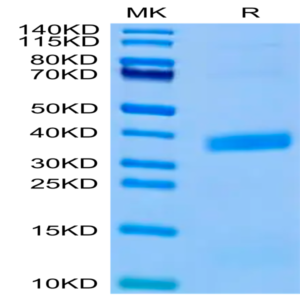 Biotinylated Human APOE3/Apolipoprotein E Protein (Primary Amine Labeling) (APO-HM101B)