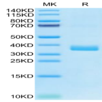 Human APOE4/Apolipoprotein E Protein (APO-HM102)