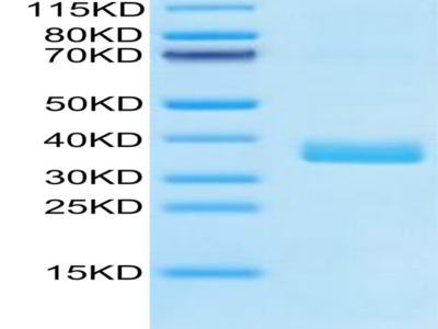 Human APOE4/Apolipoprotein E Protein (APO-HM102)