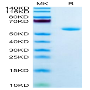 Human APOA1 Protein (APO-HM201)