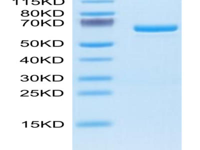 Human APOE4/Apolipoprotein E Protein (APO-HM202)