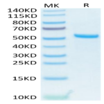 Human APRIL/TNFSF13 Trimer Protein (APR-HM110)