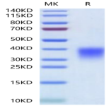 Human Activin RIIA/ACVR2A Protein (ARA-HM12A)