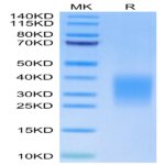 Human Activin RIIB/ACVR2B Protein (ARB-HM12B)