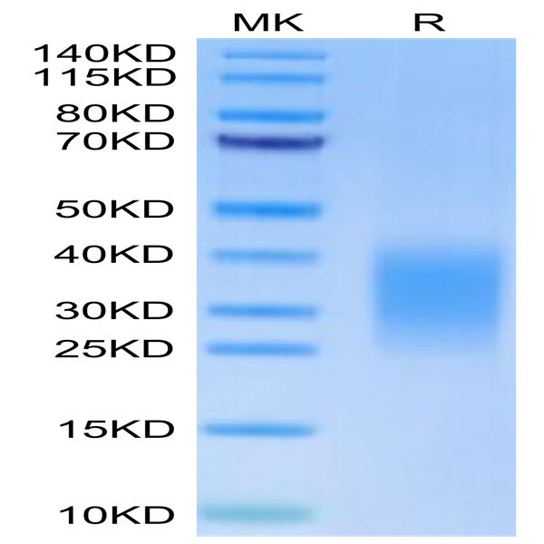 Human Activin RIIB/ACVR2B Protein (ARB-HM12B)