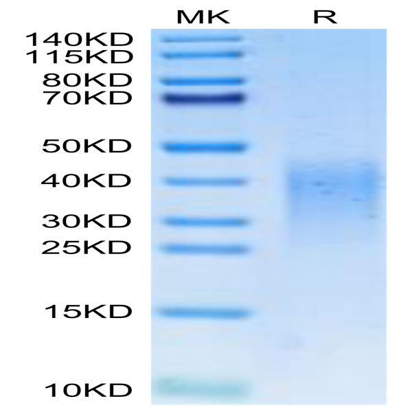 Mouse Activin RIIB/ACVR2B Protein Protein (ARB-MM12B)