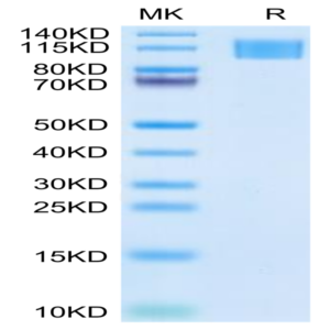 Human Aggrecan Protein (ARN-HM101)