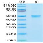 Human ARTN Protein (ARN-HM201)