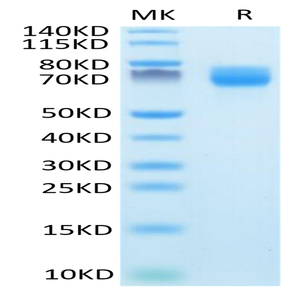 Mouse ARTN Protein (ARN-MM201)