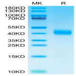 Human ASGR1 Protein (ASG-HM1R1)