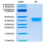 Mouse ASGR1 Protein (ASG-MM1R1)