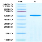 Human Adenylosuccinate Lyase Protein (ASL-HE001)