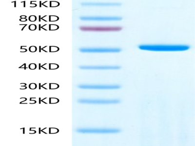 Human Adenylosuccinate Lyase Protein (ASL-HE001)