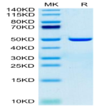 Human ASPH Protein (ASP-HE101)