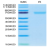 Cynomolgus AXL Protein (AXL-CM102)