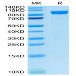 Human AXL Protein (AXL-HM201)