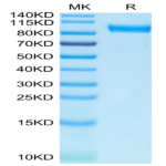 Biotinylated Human Axl Protein (Primary Amine Labeling) (AXL-HM201B)