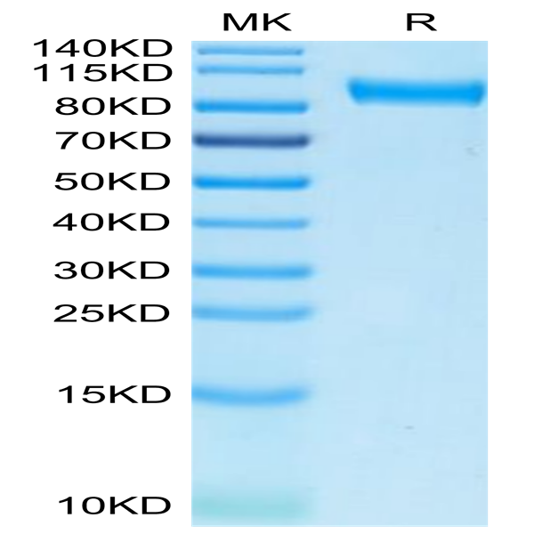 Biotinylated Human Axl Protein (Primary Amine Labeling) (AXL-HM201B)