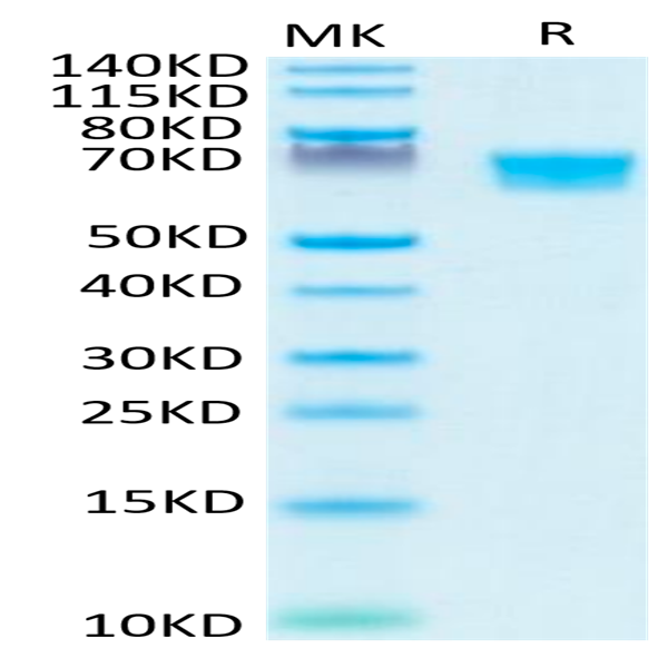 Human AXL Protein (AXL-HM401)
