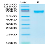 Biotinylated Human AXL Protein (AXL-HM401B)