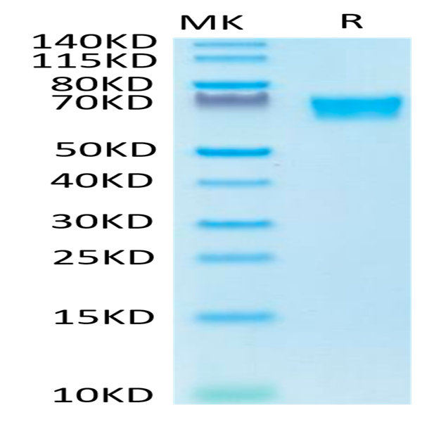 Biotinylated Human AXL Protein (AXL-HM401B)