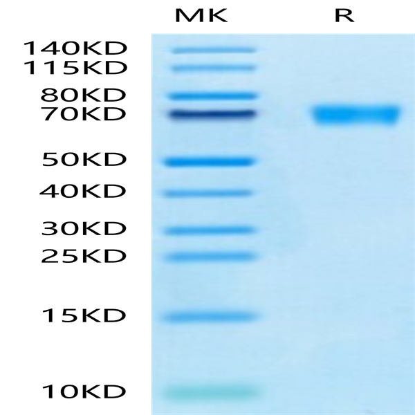 Mouse AXL Protein (AXL-MM101)