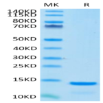 Cynomolgus/Rhesus macaque B2M/beta 2-Microglobulin Protein (B2M-CM101)
