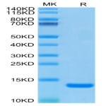Human B2M/beta 2-Microglobulin Protein (B2M-HM101)