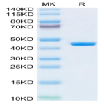 Human B2M/beta 2-Microglobulin Protein (B2M-HM201)